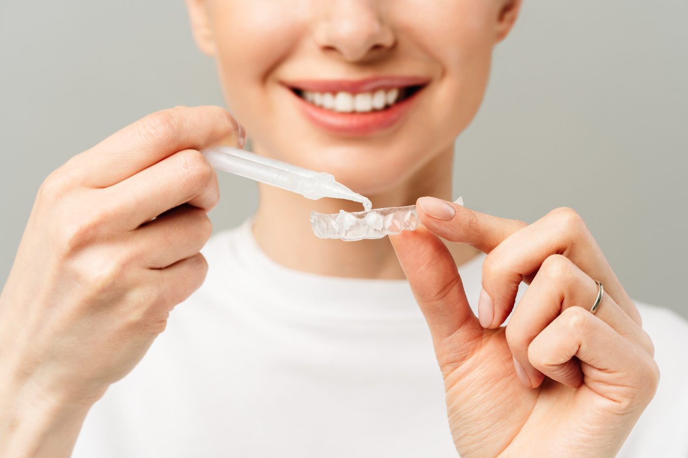 Professional teeth whitening