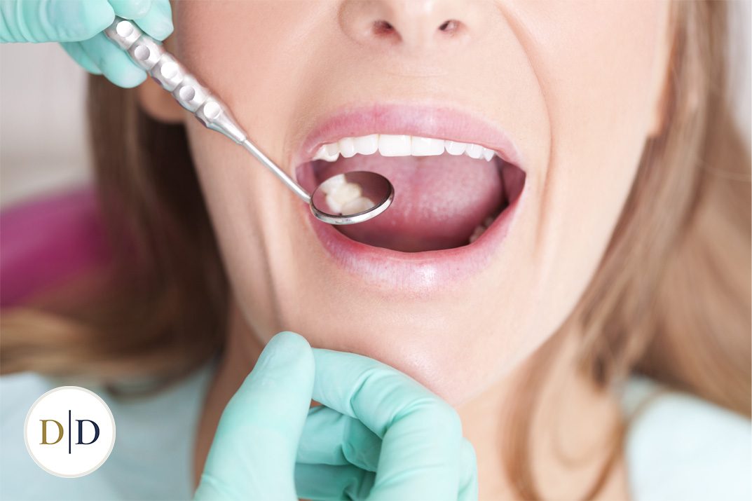 Dentist examining a patient's teeth during a white filling appointment